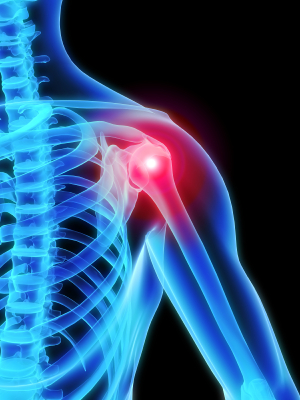 shoulder_pain